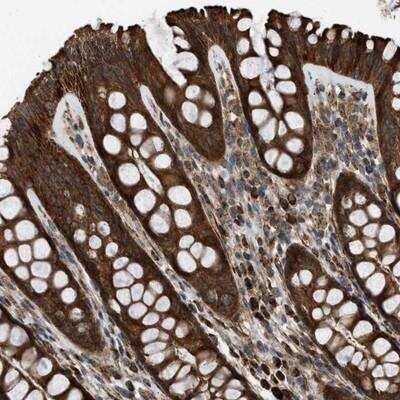 Immunohistochemistry-Paraffin: SESN2 Antibody [NBP1-85029]