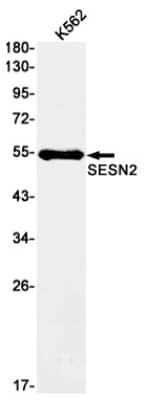 Western Blot: SESN2 Antibody (S05-8C1) [NBP3-19769]