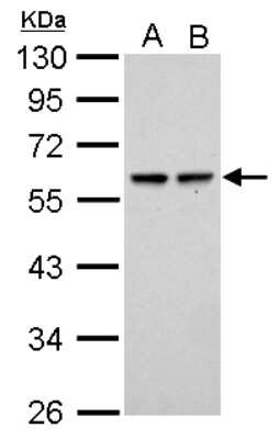 Western Blot: SESN2 Antibody [NBP2-20317]