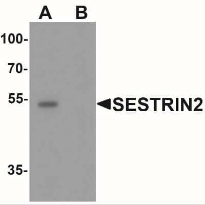 Western Blot: SESN2 AntibodyBSA Free [NBP2-41302]