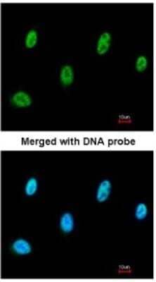 Immunocytochemistry/ Immunofluorescence: SESN3 Antibody [NBP1-31702]