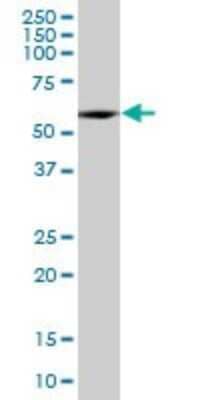 Western Blot: SESN3 Antibody [H00143686-B01P]