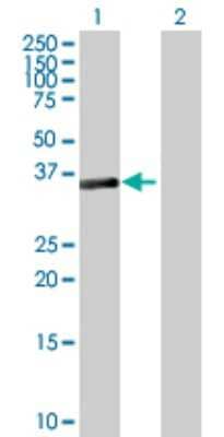 Western Blot: SESN3 Antibody [H00143686-B01P]