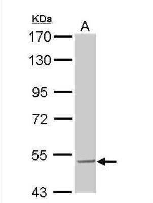Western Blot: SESN3 Antibody [NBP1-31702]