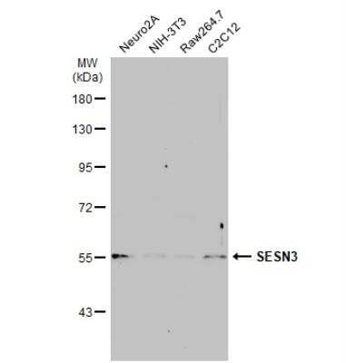 Western Blot: SESN3 Antibody [NBP1-31702]