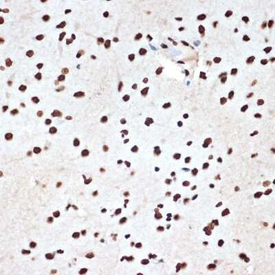 Immunohistochemistry-Paraffin: SET Antibody (8E8M9) [NBP3-16775]