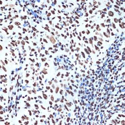 Immunohistochemistry-Paraffin: SET Antibody (8E8M9) [NBP3-16775]