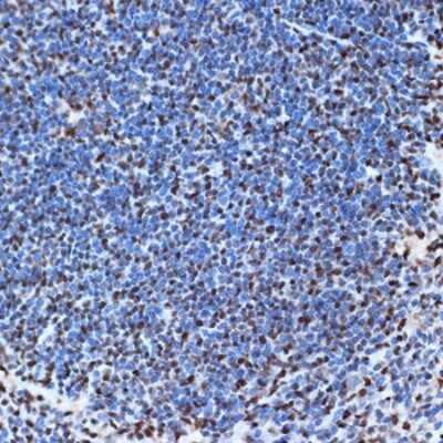 Immunohistochemistry-Paraffin: SET Antibody (8E8M9) [NBP3-16775]