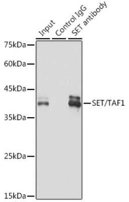 Immunoprecipitation: SET Antibody (8E8M9) [NBP3-16775]