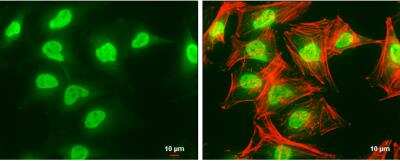 Immunocytochemistry/ Immunofluorescence: SET Antibody [NBP1-30888]