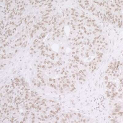Immunohistochemistry: SET Antibody [NBP1-26646]