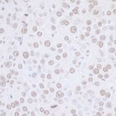 Immunohistochemistry: SET Antibody [NBP1-26646]