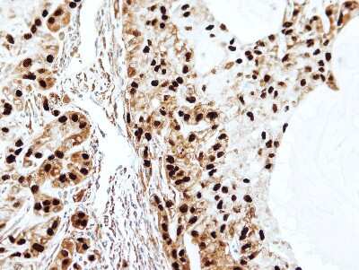 Immunohistochemistry-Paraffin: SET Antibody [NBP1-30888]