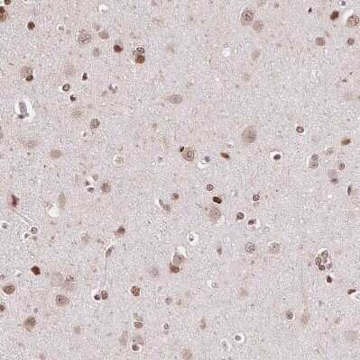 Immunohistochemistry-Paraffin: SET Antibody [NBP2-38031]
