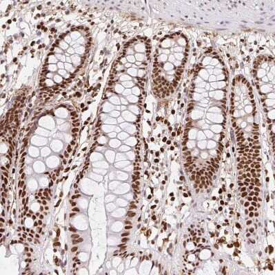 Immunohistochemistry-Paraffin: SET Antibody [NBP2-38031]