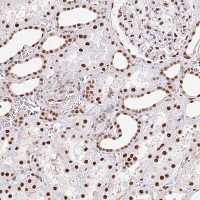 Immunohistochemistry-Paraffin: SET Antibody [NBP2-38031]