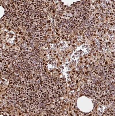 Immunohistochemistry-Paraffin: SET Antibody [NBP2-38031]