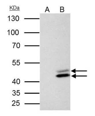 Immunoprecipitation: SET Antibody [NBP1-33713]