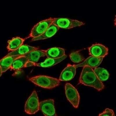 Immunocytochemistry/ Immunofluorescence: SET Antibody (PCRP-SET-1C6) - Azide and BSA Free [NBP3-08730]