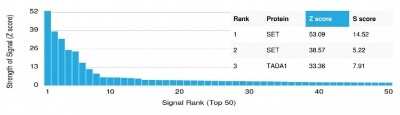 Protein Array: SET Antibody (PCRP-SET-1C6) [NBP3-07837]