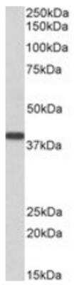 Western Blot: SET Antibody [NB100-817]