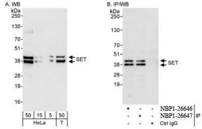 Western Blot: SET Antibody [NBP1-26646]
