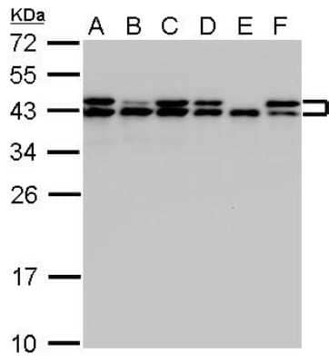 Western Blot: SET Antibody [NBP1-33713]