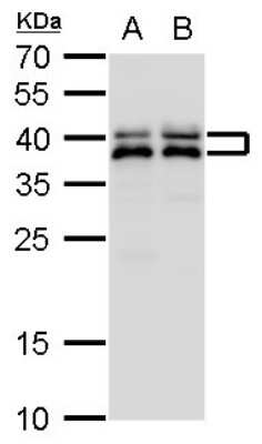 Western Blot: SET Antibody [NBP1-33713]