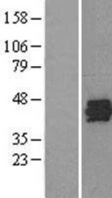 Western Blot: SET Overexpression Lysate [NBL1-15867]