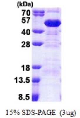 SDS-PAGE: Recombinant Human SET His Protein [NBP2-23464]