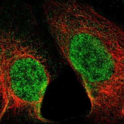 Immunocytochemistry/ Immunofluorescence: SET1B Antibody [NBP1-87896]