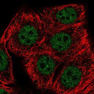 Immunocytochemistry/ Immunofluorescence: SET1B Antibody [NBP2-55848]