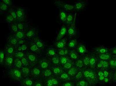 Immunocytochemistry/ Immunofluorescence: SET1B Antibody [NBP3-06532]