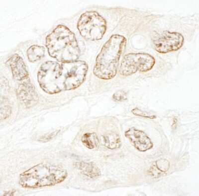 Immunohistochemistry: SET1B Antibody [NBP1-28684]