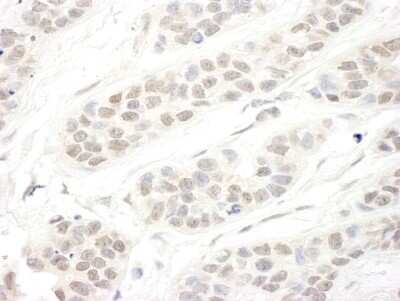 Immunohistochemistry-Paraffin: SET1B Antibody [NBP1-28685]