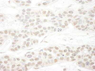 Immunohistochemistry-Paraffin: SET1B Antibody [NBP1-28684]