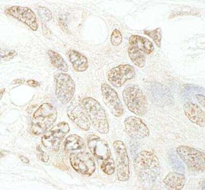 Immunohistochemistry-Paraffin: SET1B Antibody [NBP1-28684]