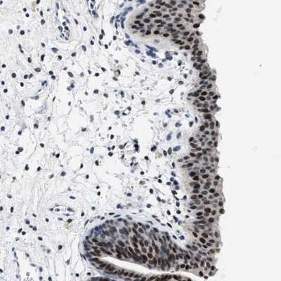 Immunohistochemistry-Paraffin: SET1B Antibody [NBP1-87896]