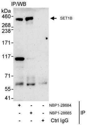 Immunoprecipitation: SET1B Antibody [NBP1-28685]