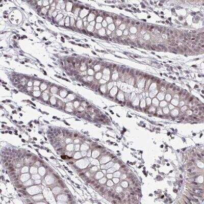 Immunohistochemistry-Paraffin: SETBP1 Antibody [NBP2-31667]