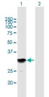 Western Blot: SETBP1 Antibody [H00026040-B01P]