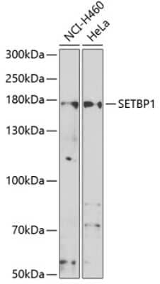 Western Blot: SETBP1 AntibodyBSA Free [NBP2-93021]