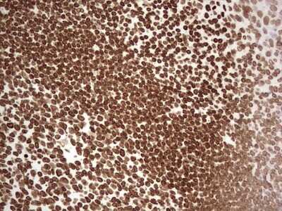 Immunohistochemistry: SETD1A Antibody (OTI7B7) [NBP2-45790]