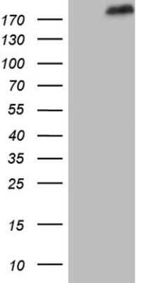 Western Blot: SETD1A Antibody (OTI7B7) [NBP2-45790]