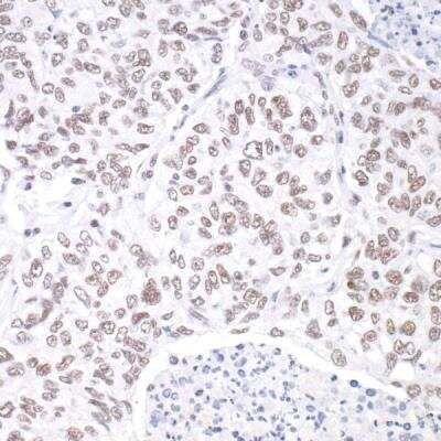 Immunohistochemistry-Paraffin: SETD1A Antibody (BLR024E) [NBP2-76401]