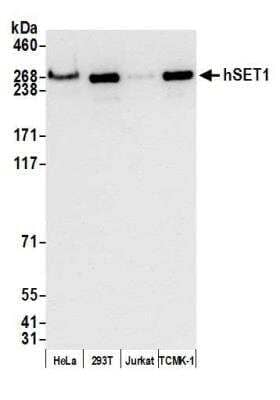 Western Blot: SETD1A Antibody (BLR024E) [NBP2-76401]