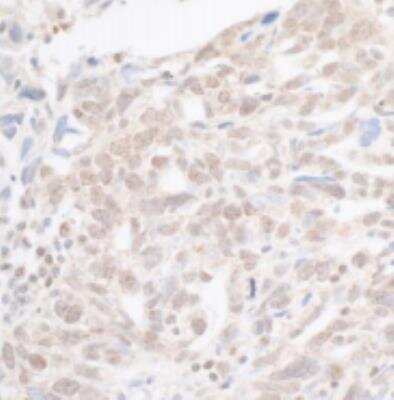 Immunohistochemistry-Paraffin: SETD1A Antibody [NB100-558]