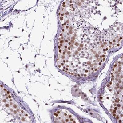Immunohistochemistry-Paraffin: SETD1A Antibody [NBP2-49281]