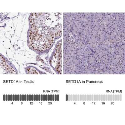 Immunohistochemistry-Paraffin: SETD1A Antibody [NBP2-49281]