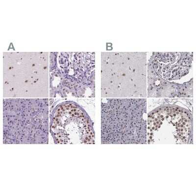 Immunohistochemistry-Paraffin: SETD1A Antibody [NBP2-49281]